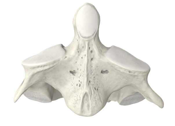 <p>Identify the part of the vertebra (side profile) and explain what diagnostic features helped you reach your conclusion.</p>