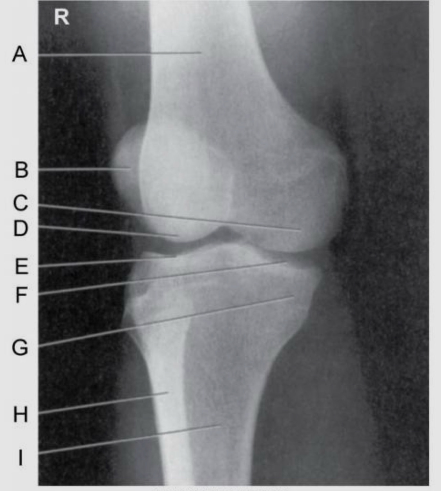 <p>Label the image.</p>