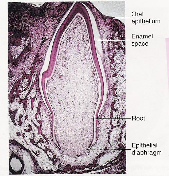 <p>Q: What causes the breakdown of the oral epithelium during eruption?</p>