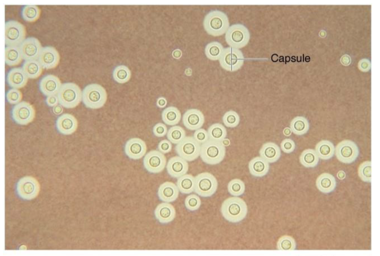 <ul><li><p>nervous fungal disease</p></li><li><p>cause: <em>Cryptococcus neoformans</em> (<em>C. gatti</em>, <em>C, grubii</em>)</p><ul><li><p>encapsulated, opportunistic</p></li></ul></li><li><p>transmission: airborne spores; contaminated soil from bird poop</p></li><li><p>symptoms: pulmonary infection (alveoli); cryptococcal meningitis (after travel through BS to CNS)</p></li></ul><p></p>