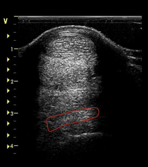 <p>what is the red circling?</p>