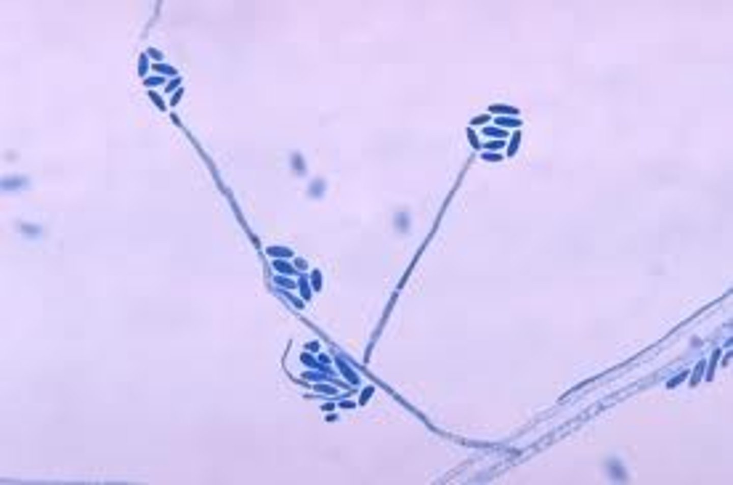 <p>rapid; 2-3 days</p><p>Wrinkled, white, gray or rose</p><p>Reverse: colorless, pale yellow, pink</p><p>Microscopic: septate hyphae; tapering conidiophores that support balls of of conidia; can be confused with Sporothrix</p><p>Conditions: keratomycosis</p>
