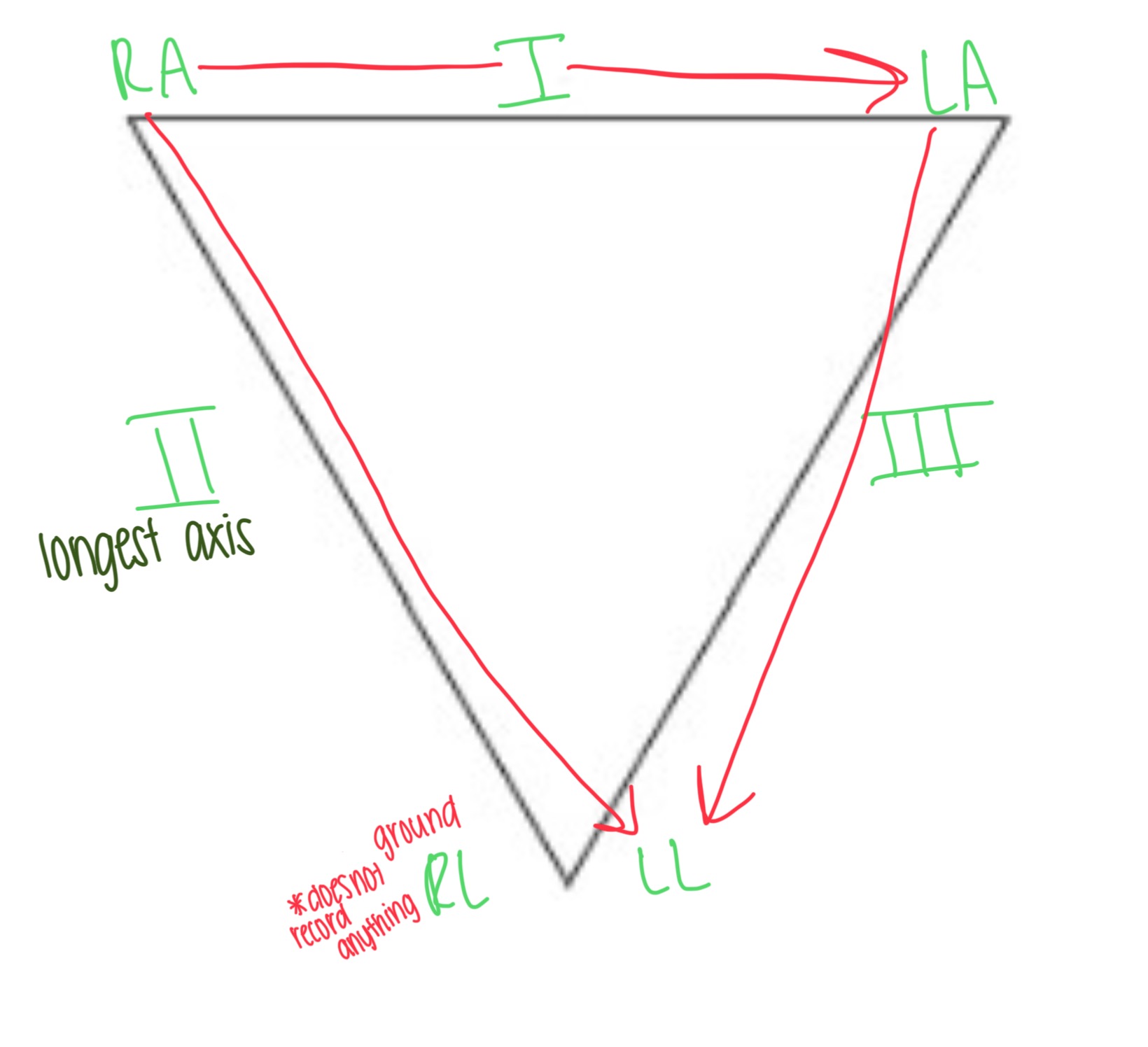 <p>A triangle formed by 3 standard limb leads (RA, LA, LL) around the heart</p><p>Lead I: RA → LA</p><p>Lead II: RA → LL</p><p>Lead III: LA → LL</p>
