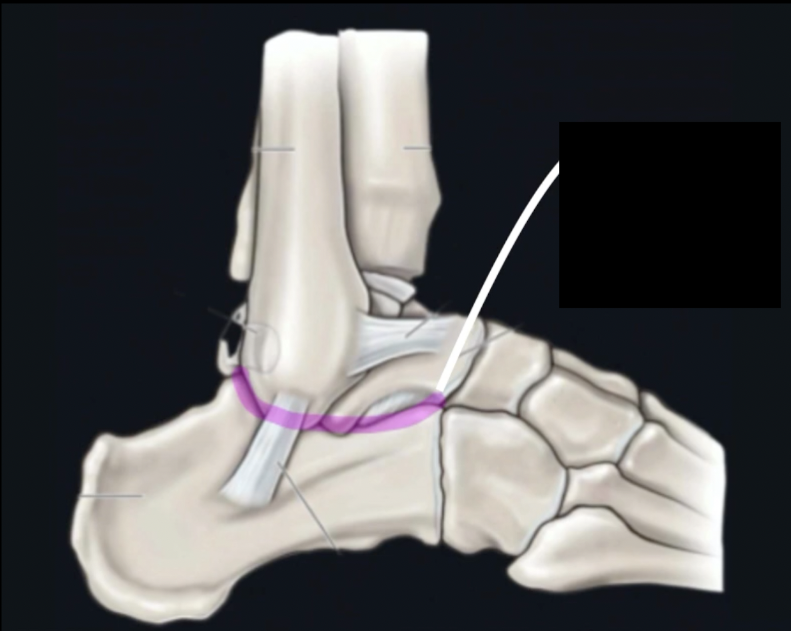 <p>What is this joint? </p>