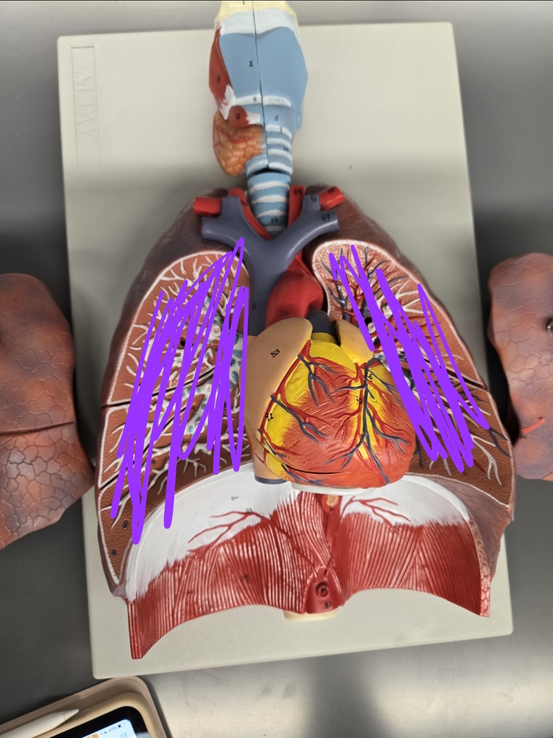 <p> What cavity is this?</p>