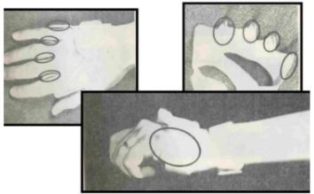 <p>Name this static splint component.</p>