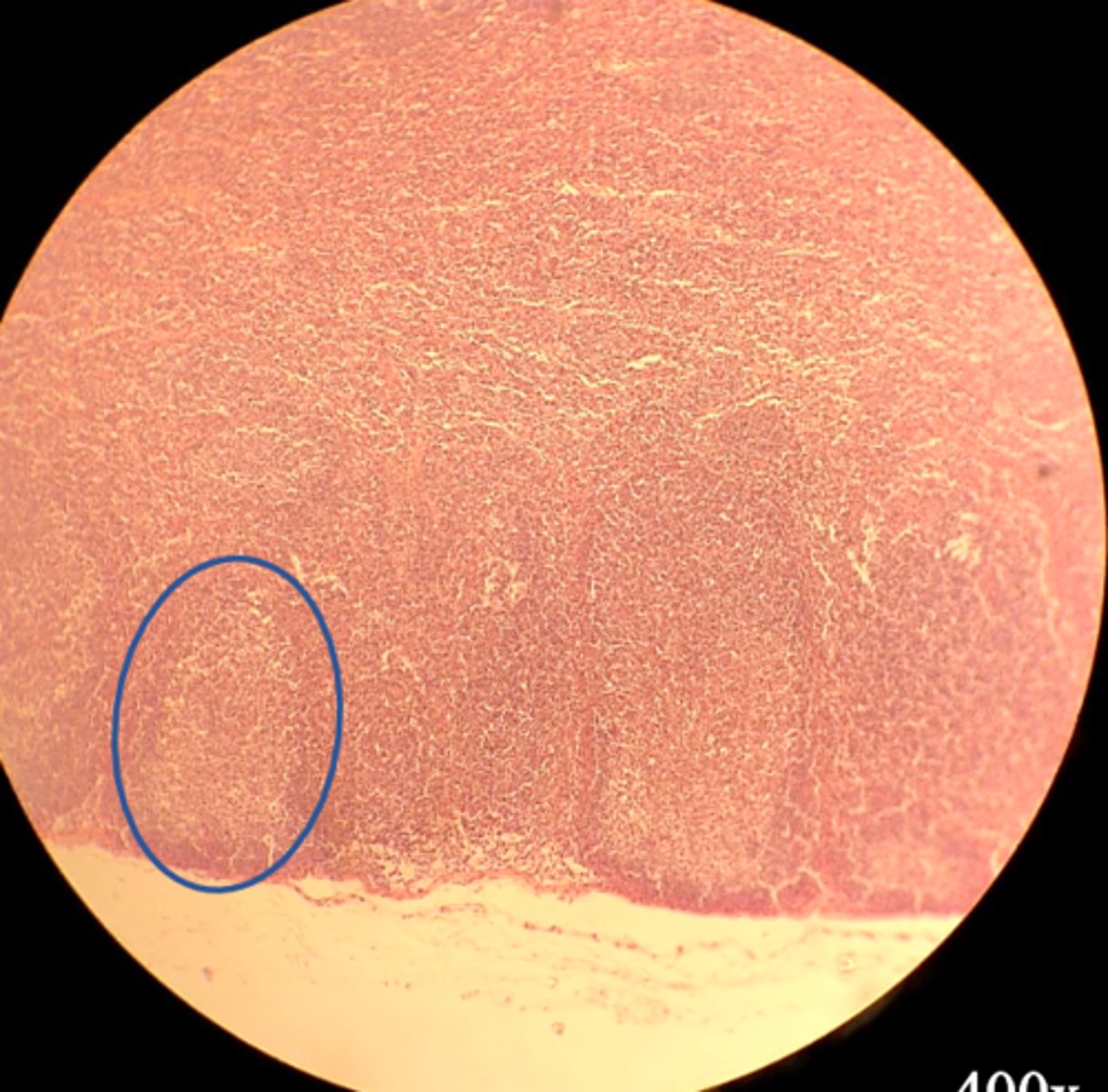 <p>What is circled</p>
