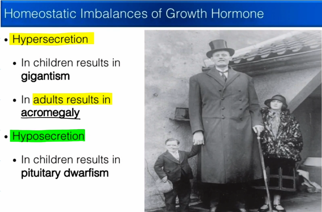 <ul><li><p>Occurs when too much GH is released during childhood.</p></li><li><p>Results in the formation of very long, weak bones.</p></li></ul><p></p>