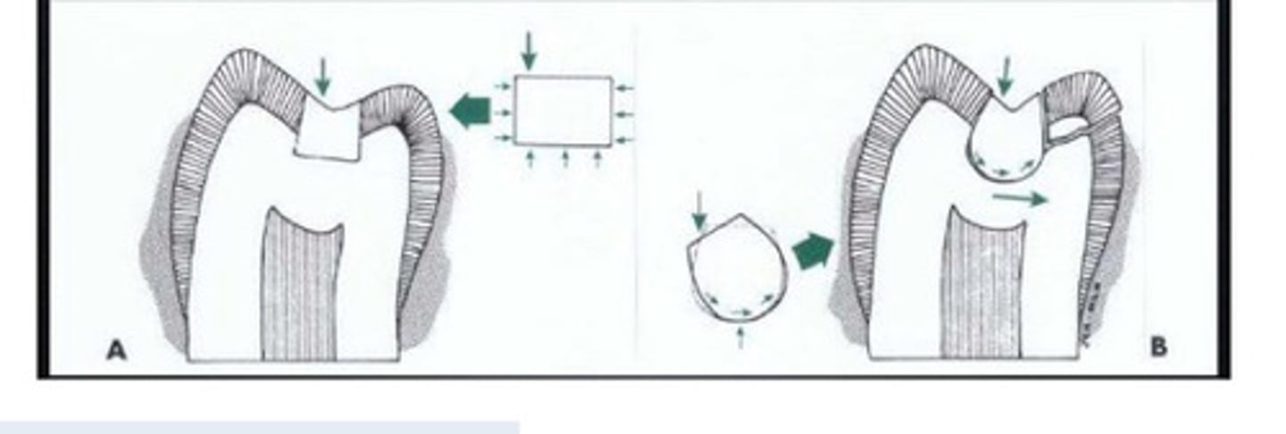 <p>For retention form, Opposing walls being slightly</p>