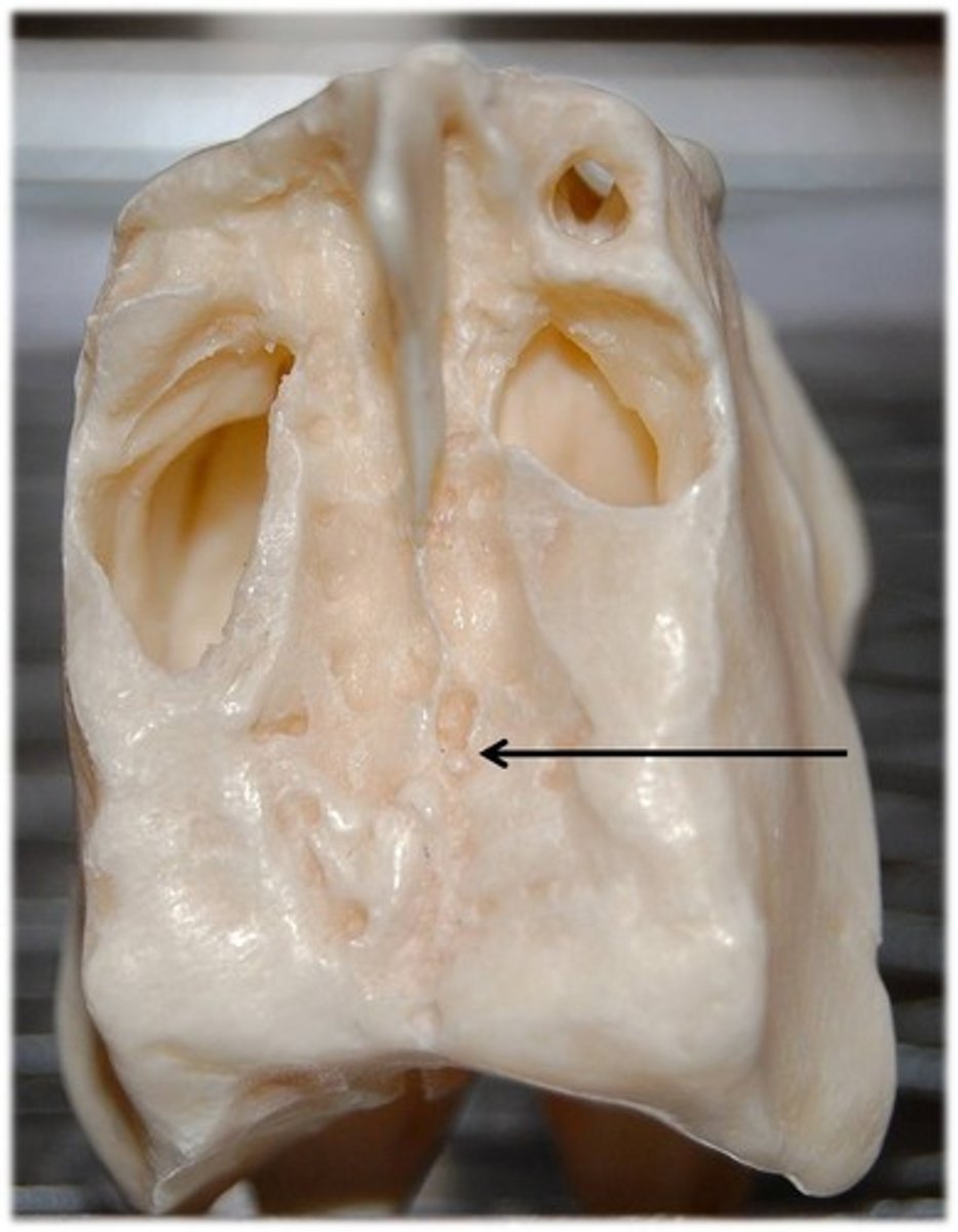 <p>structure</p><p>plate that has many tiny holes on side of crista galli posterior from it</p>