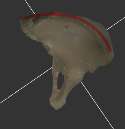 <p>Een subtiele, vaak moeilijk zichtbare lijn die de labia internum en externum scheidt op de crista iliaca.</p>