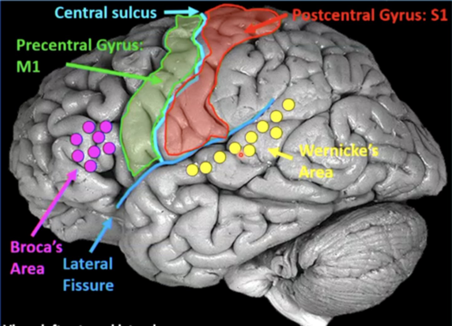 <p>cortical region:</p><p>Broca's and Wernicke's areas</p><p>cerebral lobe: frontal (Broca's) and temporal (Wernicke's)</p>