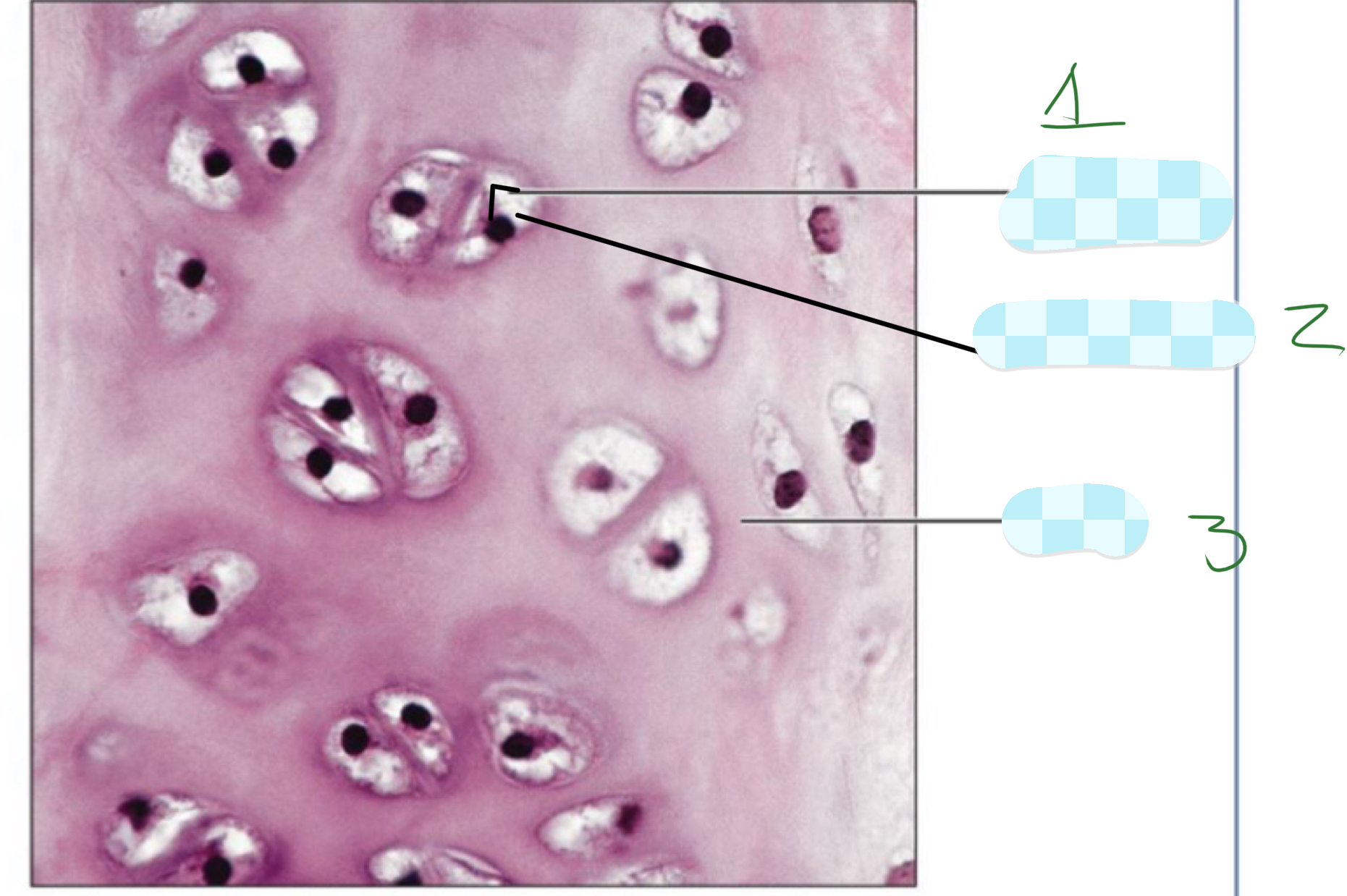 <p>3) hyaline cartilage </p>