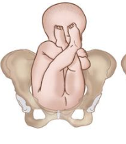 <p>hips flexed, knee extended (feet are up near the hear)</p>