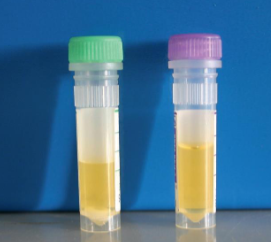 <p><span style="font-size: calc(var(--scale-factor)*39.96px)">Abdominocentesis</span><br>Colours</p><p>What does this mean?</p>