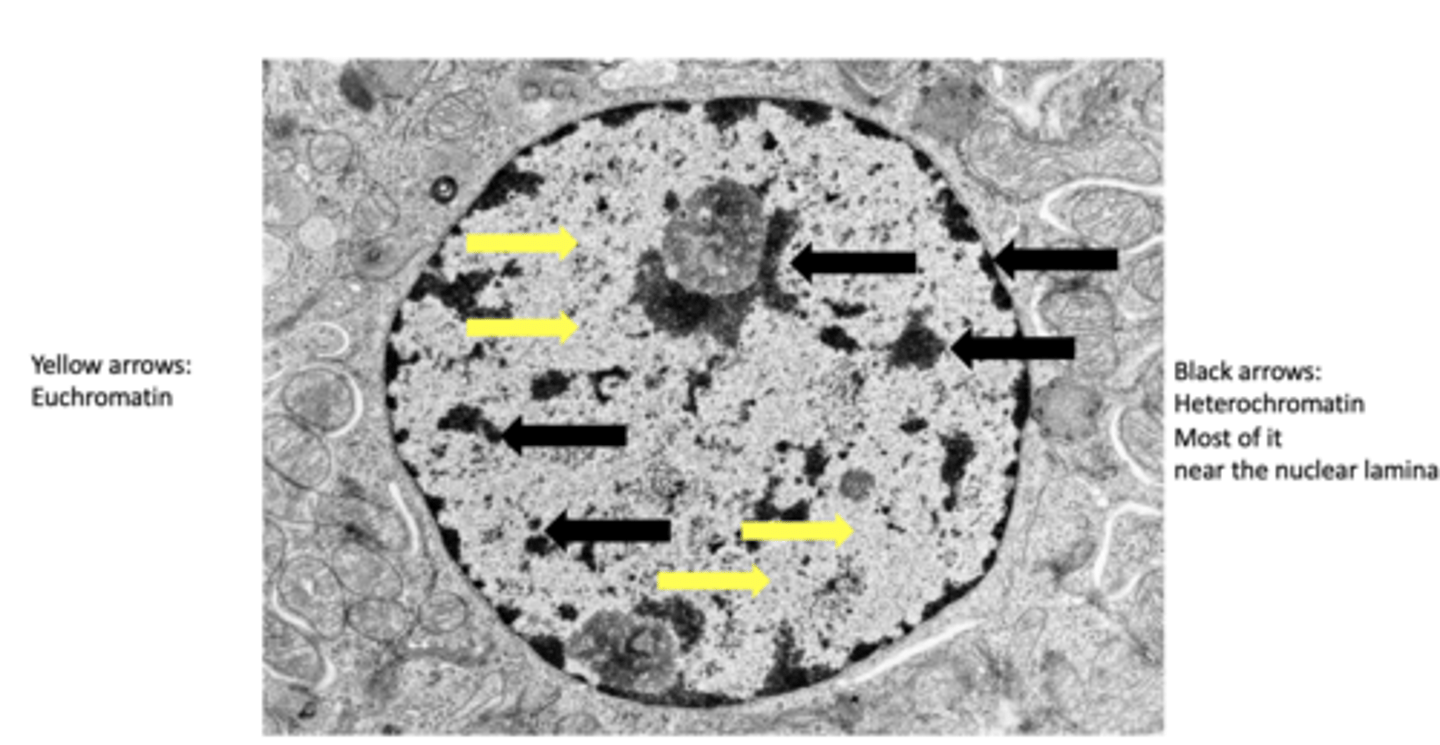 <p>How does euchromatin appear under a transmission electron microscope (TEM)?</p>