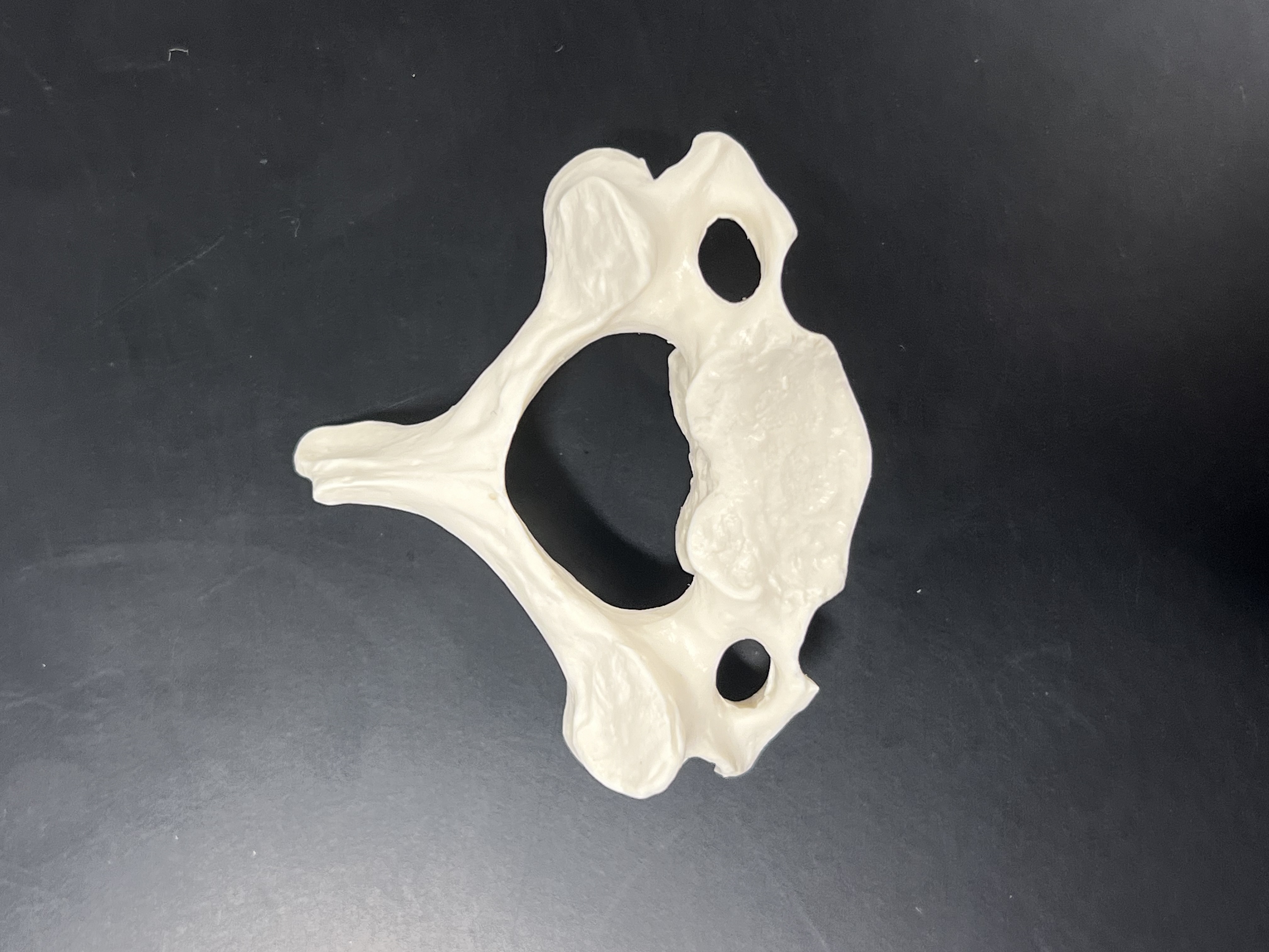 <p>what vertebrae is this</p>