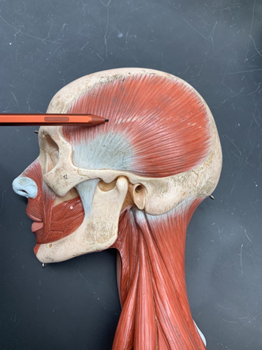 <p>O: temporal fossa</p><p>I: coronoid process of mandible</p><p>A: Elevates &amp; retracts mandible</p><p>Inn: Mandibular nerve (CN V3)</p>