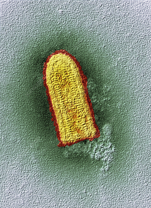 <p>A bullet-shaped, enveloped virus with linear, (-) sense ssRNA and a helical nucleocapsid</p>