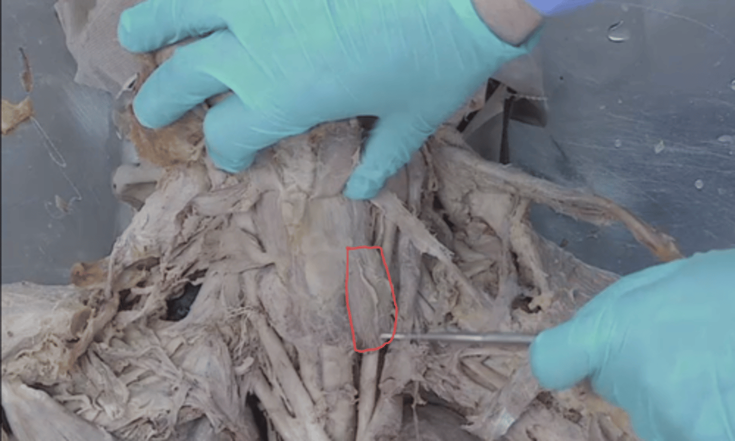 <p>identify this muscle (sternohyoid muscle reflected)</p>