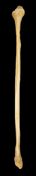 <p>What bone is this?</p><p>Left side or right side?</p><p>(Anterior view).</p>