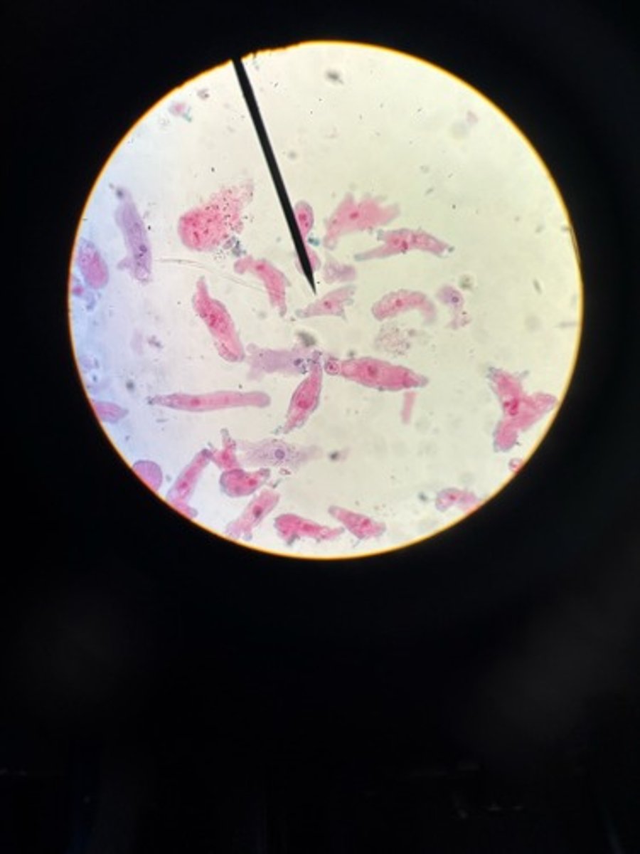 <p>Identify</p>