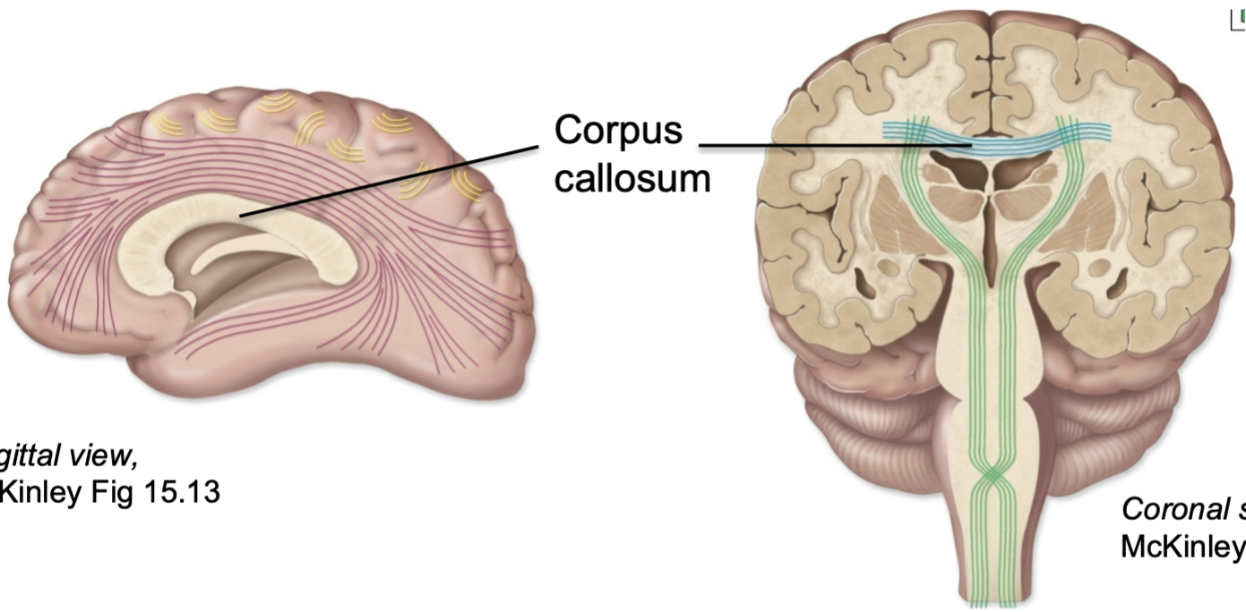 1. White matter of cerebrum 
2. Largest, most visible band of commissural fibers
- Fibers that connect two hemispheres