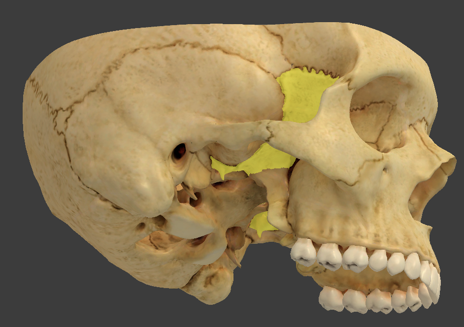 <ul><li><p>contacts every other cranial bone</p></li><li><p>made up of a median body and greater and lesser wings</p></li></ul><p></p>