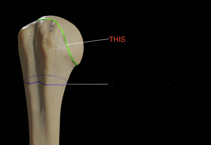 <p>humerus</p>