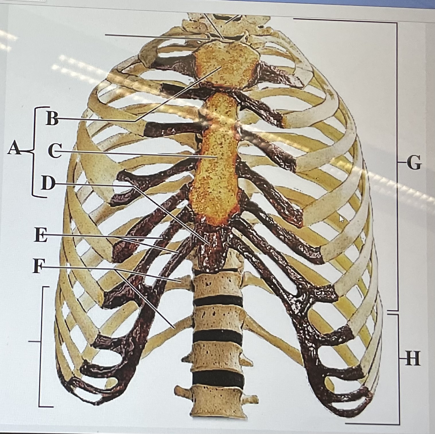 <p>in the figure above letter ____ are the false ribs and letter ____ is the manubrium </p>