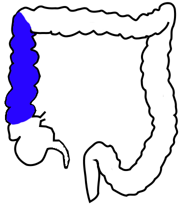 <p>The <strong><em><em></em></strong><strong><em></em></em></strong> is the part of the large intestine that moves upward from the cecum along the right side of the abdominal cavity.</p>