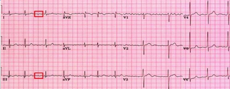 <p>what is this?</p>