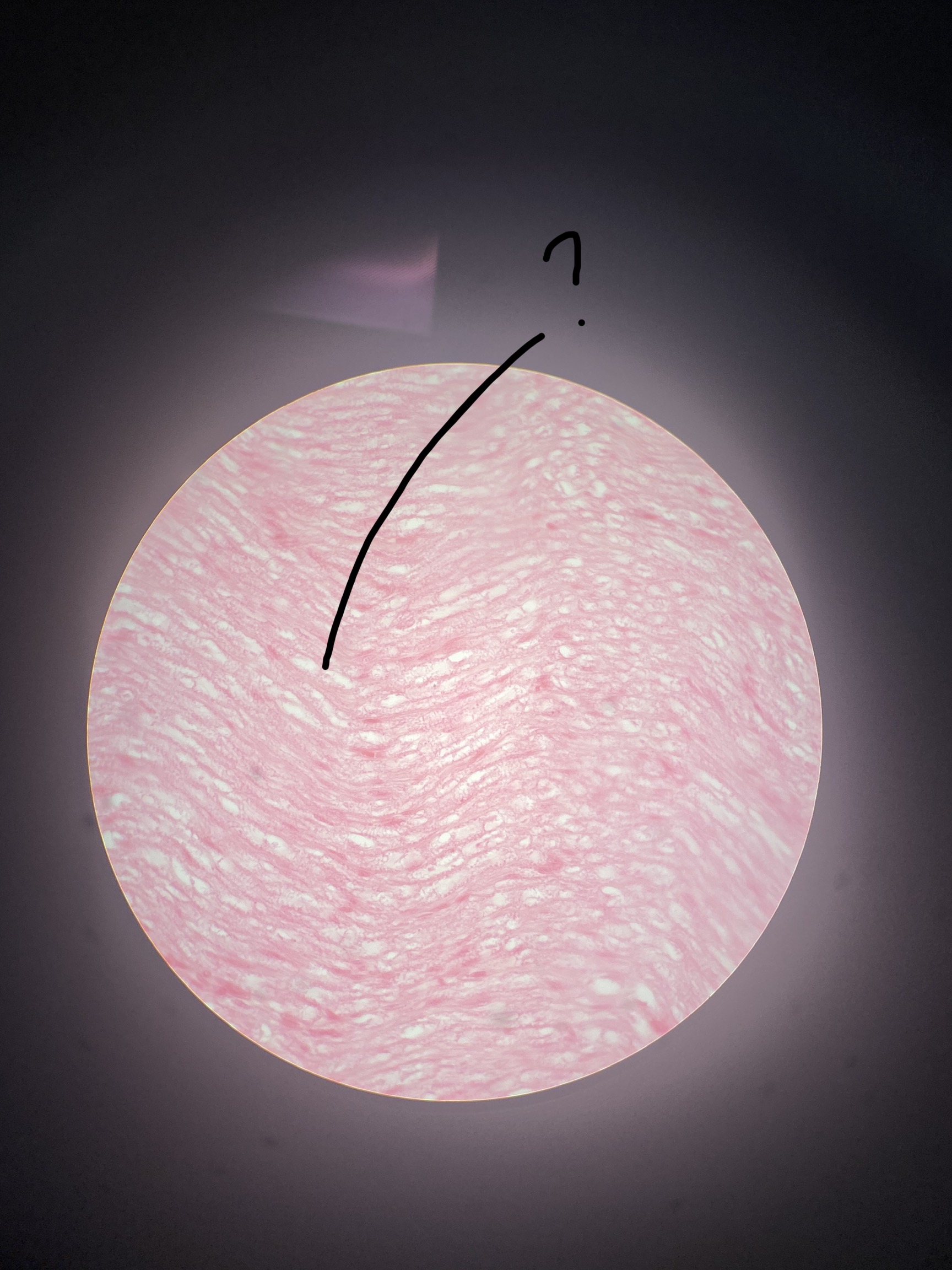 <p>What is the arrow pointing to?</p>