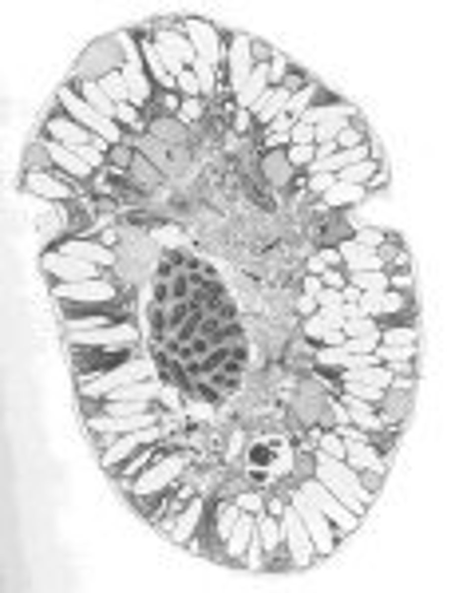 <p>dinoflagellates</p><p>-inbetween pro and euk</p><p>-that is, they have the chromosomes concentrated during the interphase.</p>
