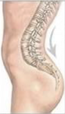 <p>Name this pathology</p>