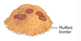 <p>remodel bones, cause them to releasee calcium, bone resorption</p>