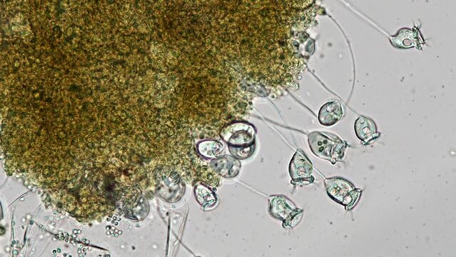 <p>Kingdom: Protista </p><p>Phylum: Ciliata (Ciliaophora) </p>