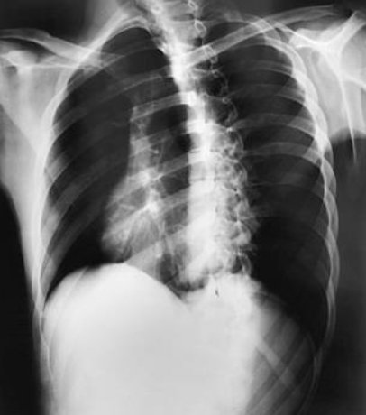 <p>What position is demonstrated?</p>