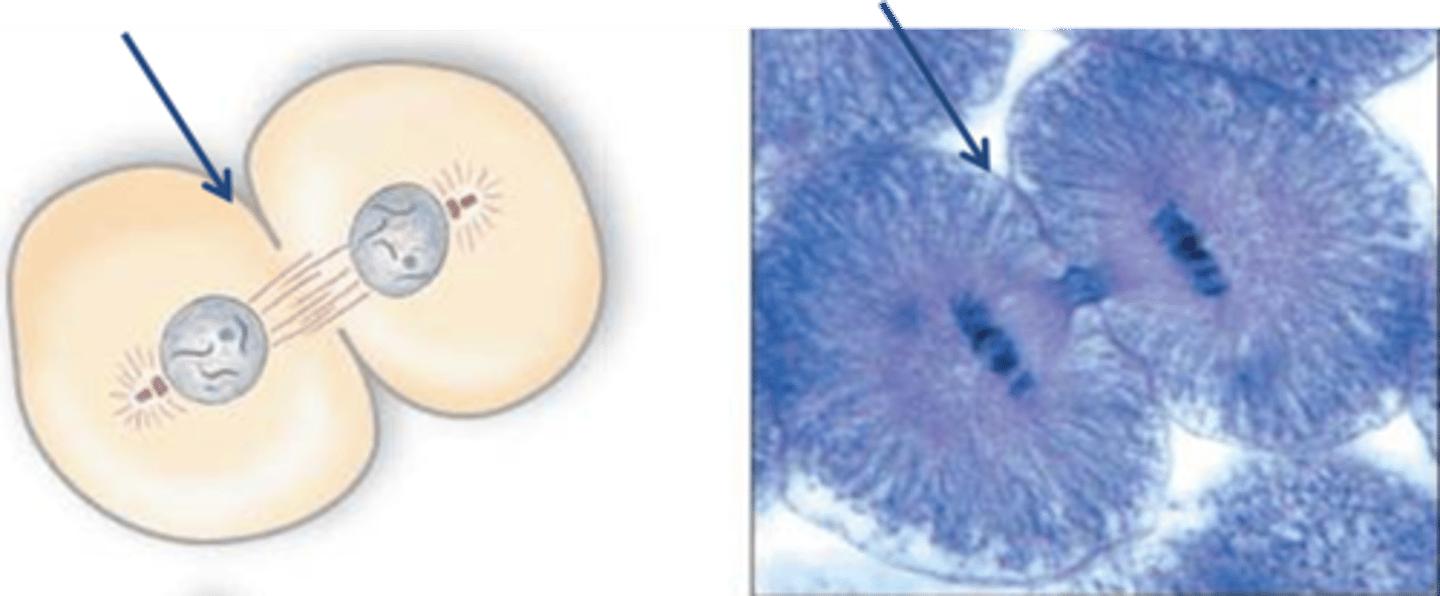 <p>The first sign of cleavage in an animal cell; a shallow groove in the cell surface near the old metaphase plate.</p>