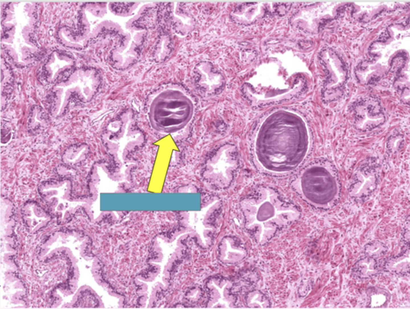 <p>identify the structure</p>