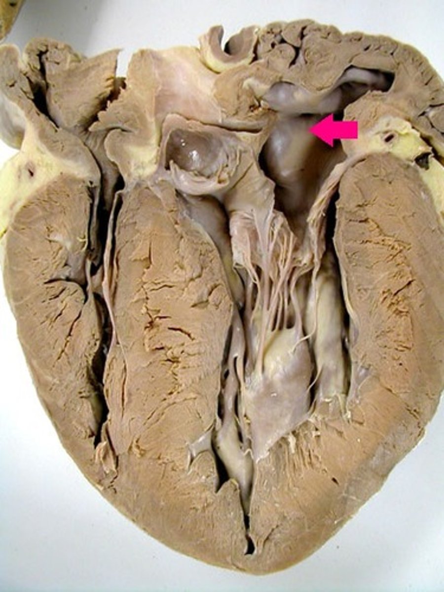 <p>Identify the inner layer.</p>