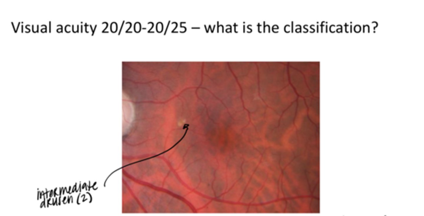 <p>What form of AMD is this pic?</p>