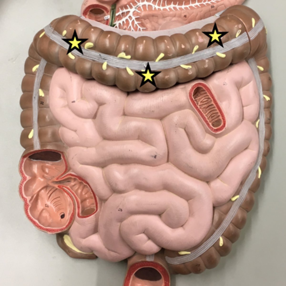 knowt flashcard image