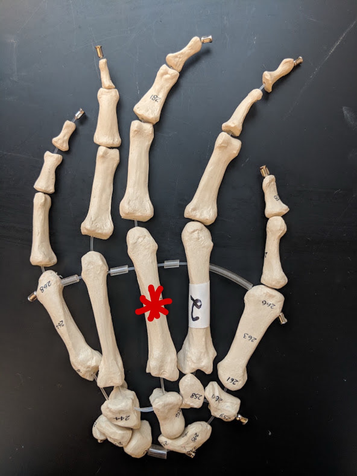 <p>Name this bone</p>