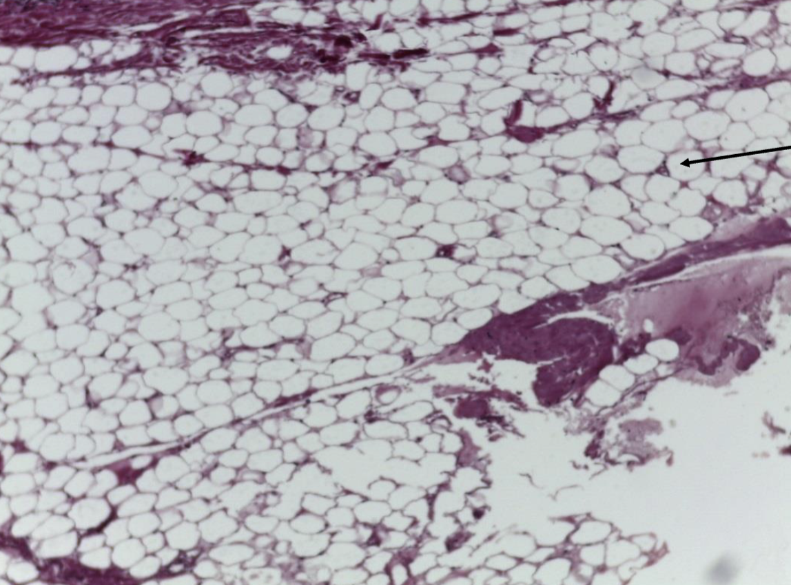 <ol><li><p><strong>Name the tissue type</strong></p></li><li><p><strong>Name the cell type</strong></p></li></ol><p></p>