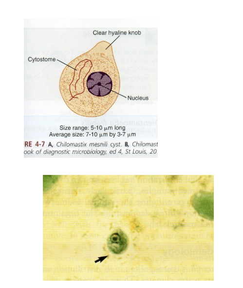 <p>What are morphology features of Chilomastix cysts?</p>