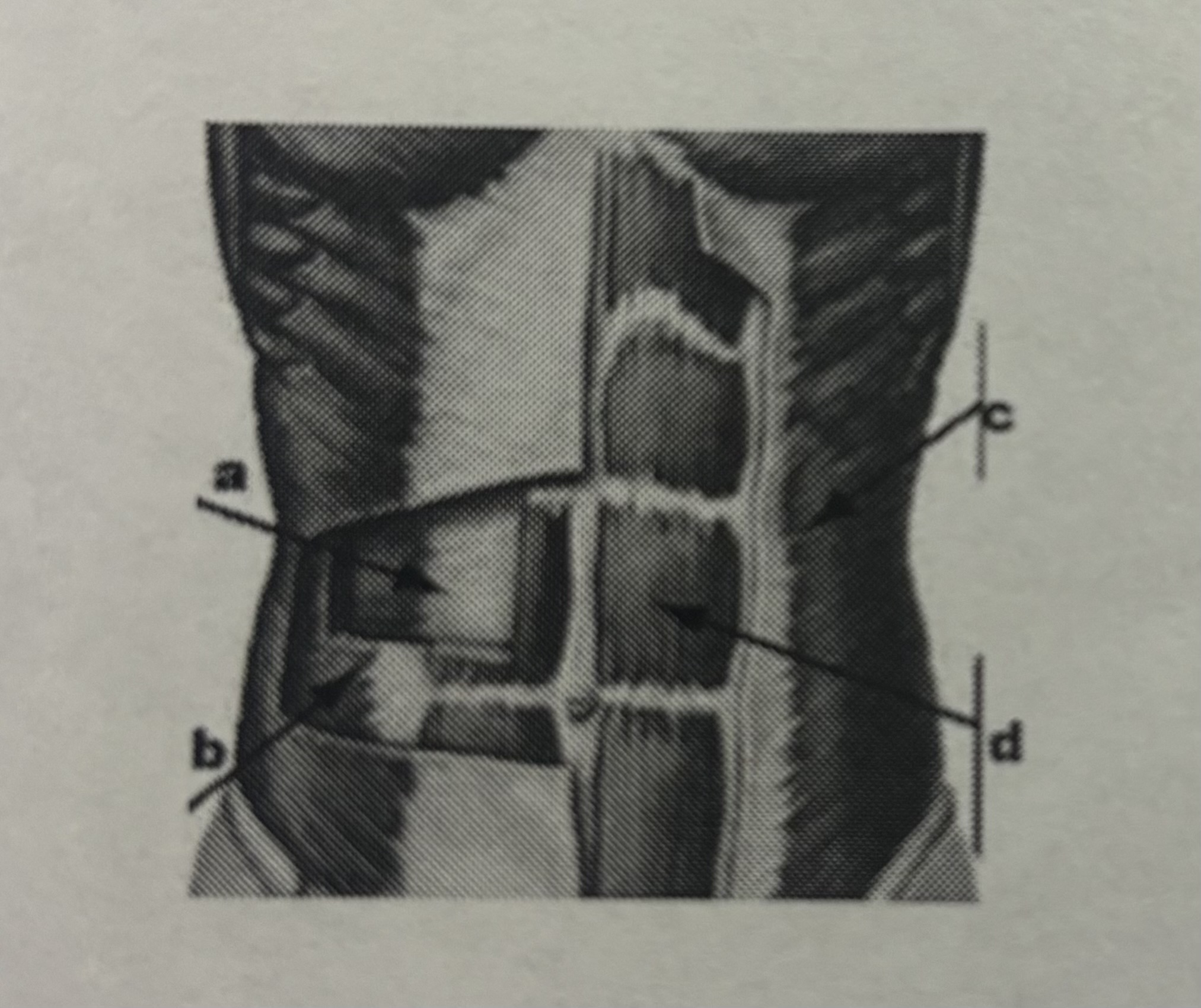 <p>External oblique muscle</p>