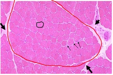 identify these muscle structures

black circle, red circle, small arrow, big arrow