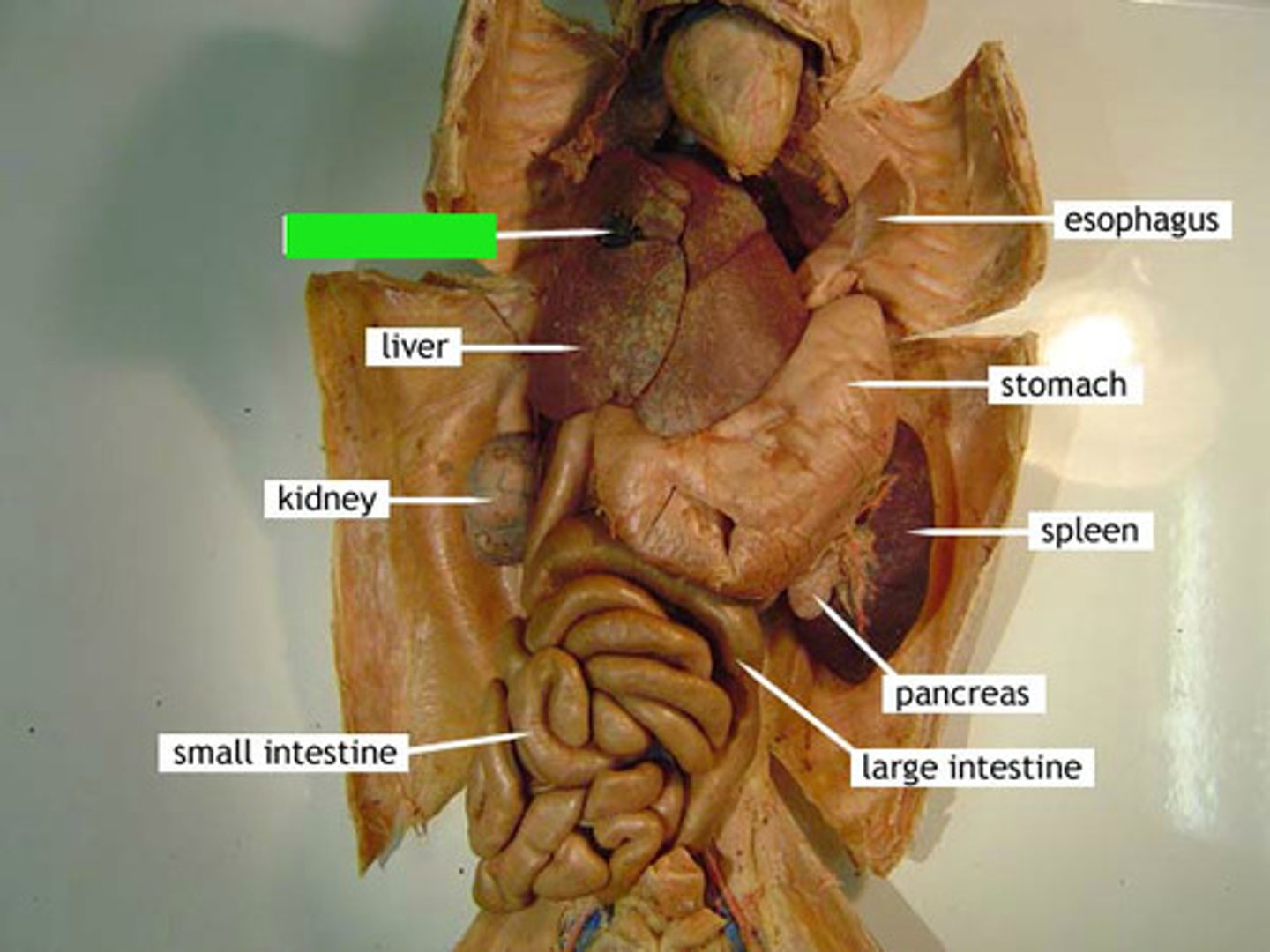<p>Identify the structure at the green pointer box.</p>