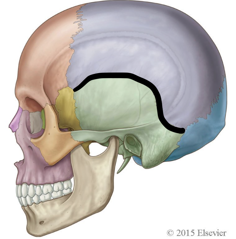 <p>which suture is highlighted here</p>